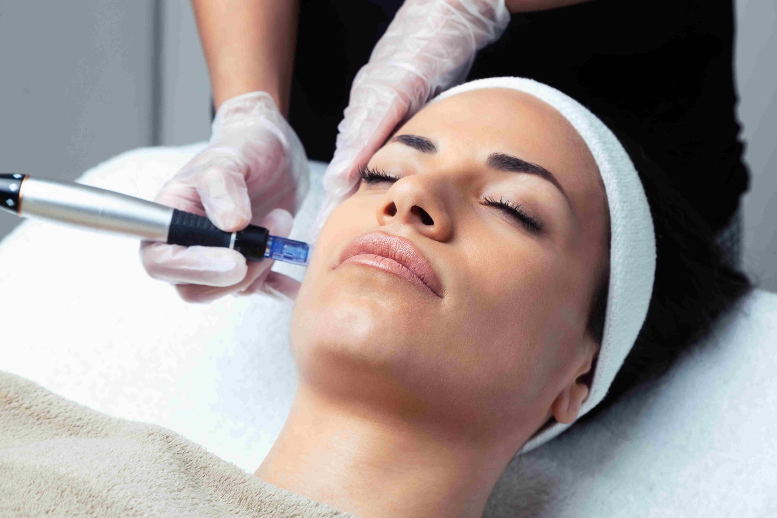 Female Receiving Virtual RF Microneedling Treatment | Avail Aesthetics in Raleigh, NC