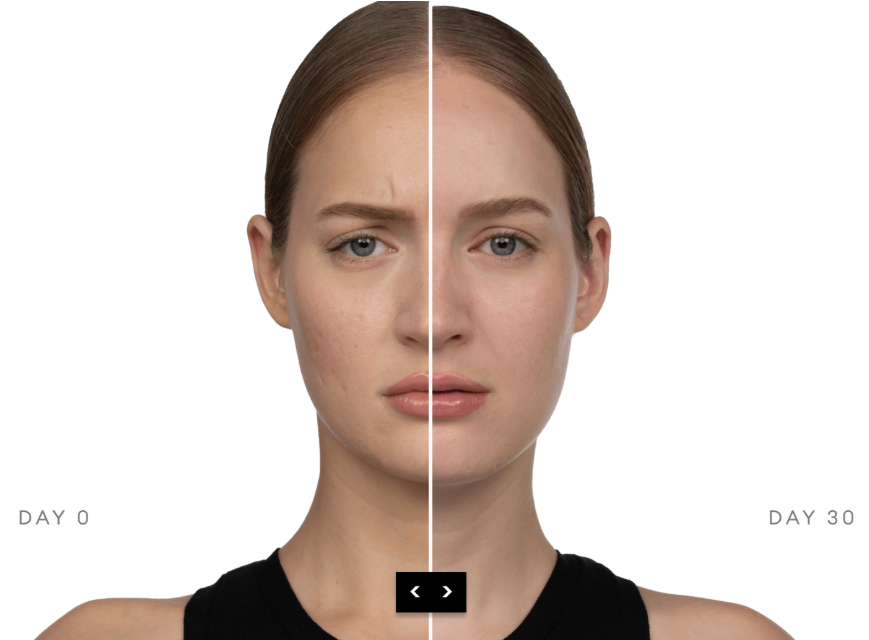 Jeuveau - Avail Aesthetics med spa in NC