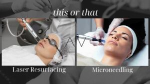 Laser Resurfacing vs Microneedling